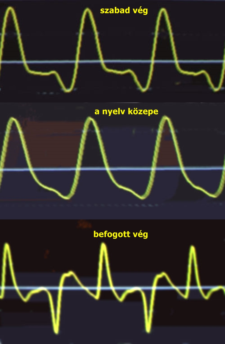 klz08