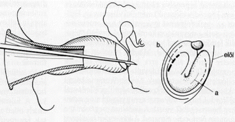 vb14